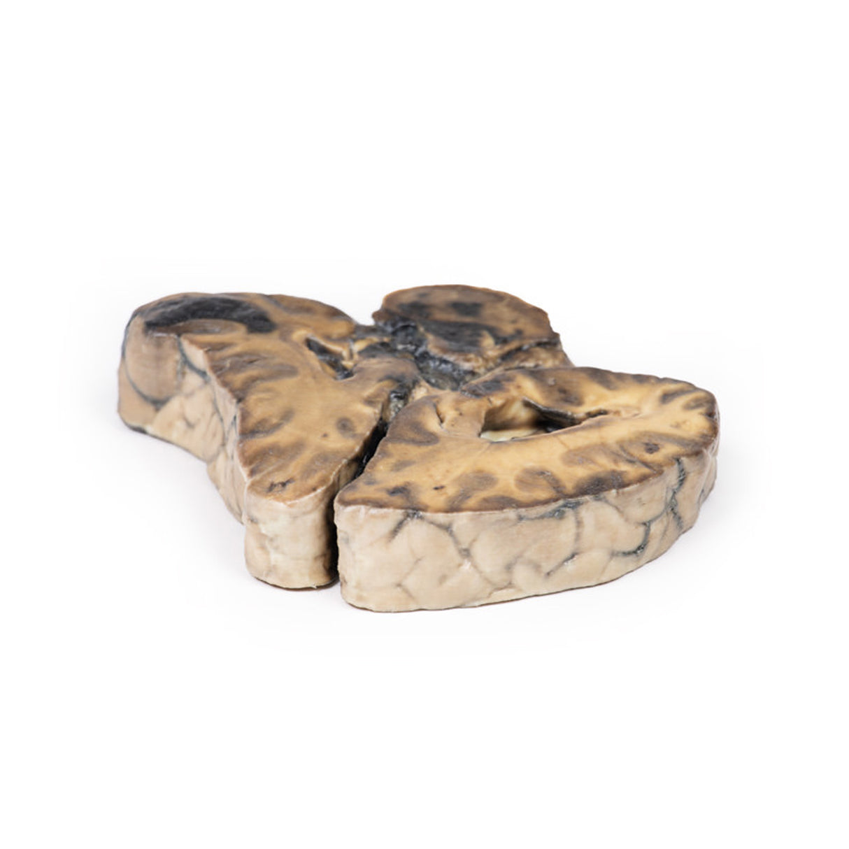 Intracranial space-occupying lesion | EZ-MP2011 | Sim & Skills Ltd