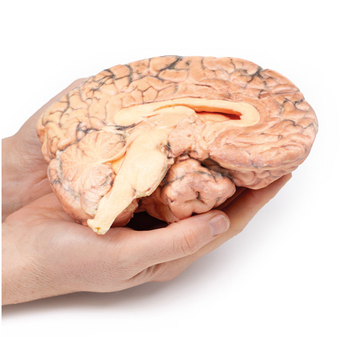 Craniopharyngioma | EZ-MP2017 | Sim & Skills Ltd