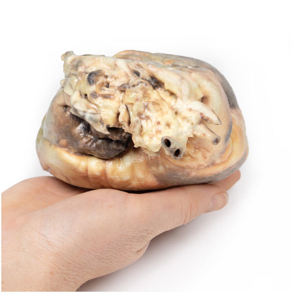 Atrial septal defect | EZ-MP2032 | SIm & Skills Ltd