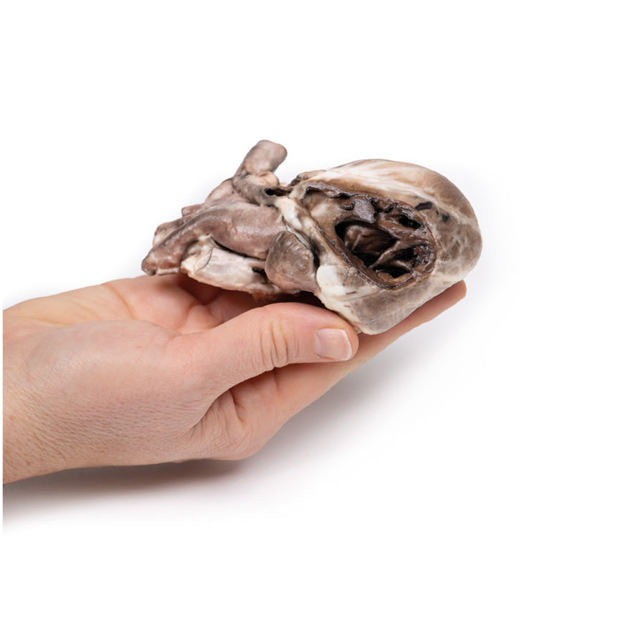 Tetralogy of Fallot | EZ-MP2037 | Sim & Skills Ltd