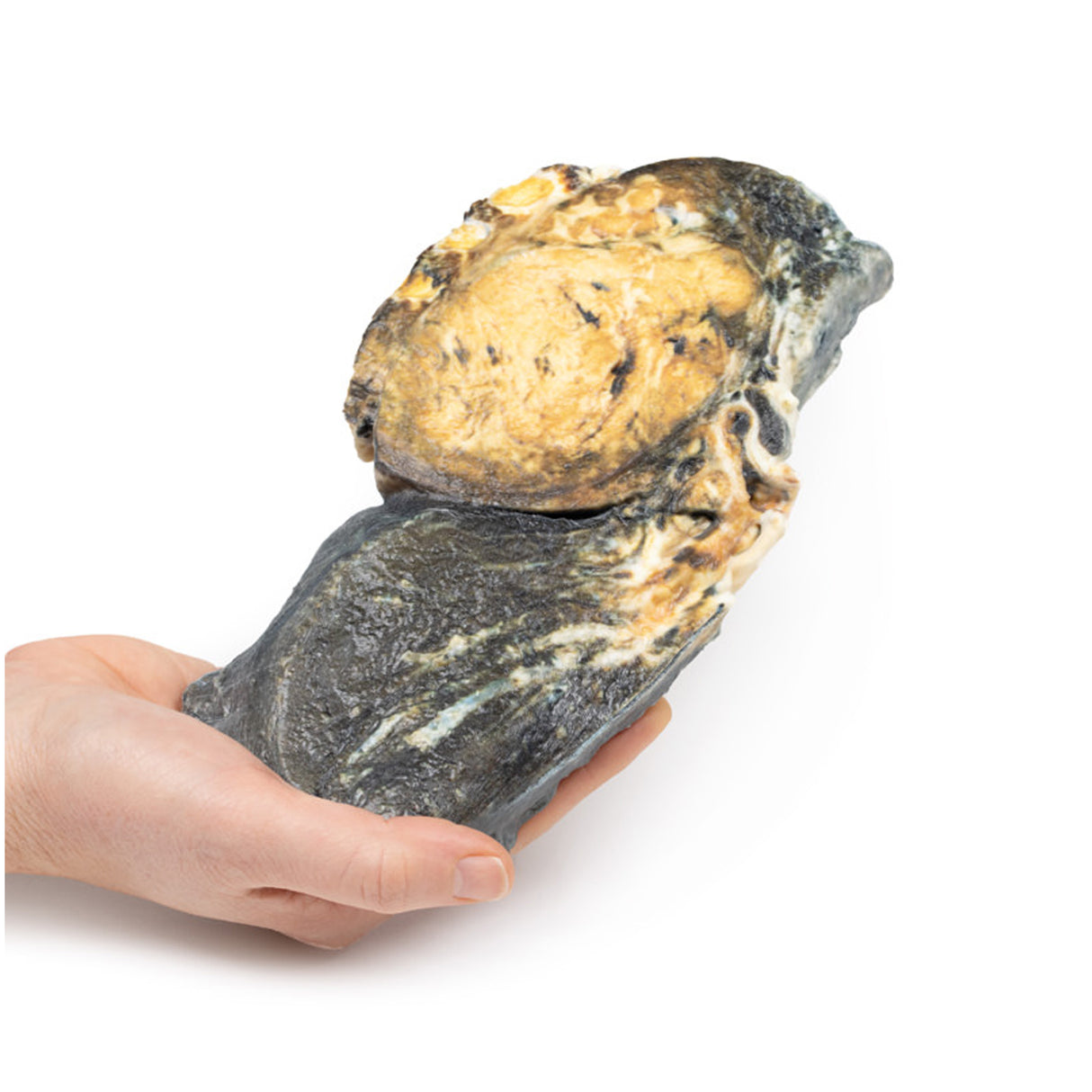 Metastatic Tumour in Lung from Primary Testicular Cancer | EZ-MP2055 | Sim & Skills Ltd