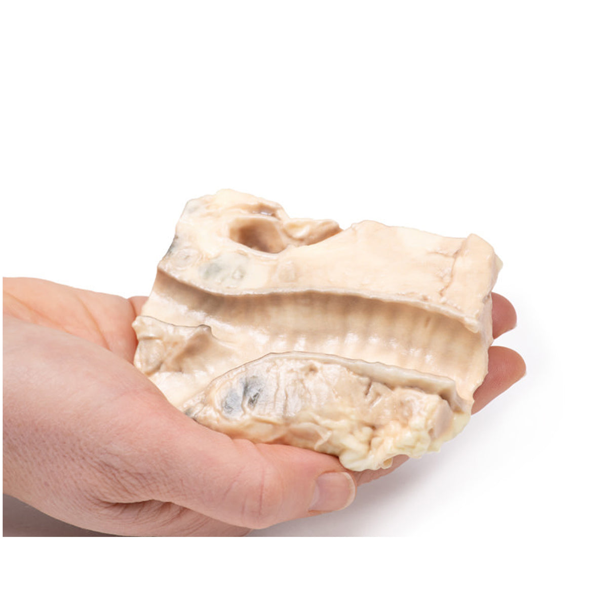 Trachea—Hodgkin Lymphoma | EZ-MP2062 | Sim & Skills Ltd
