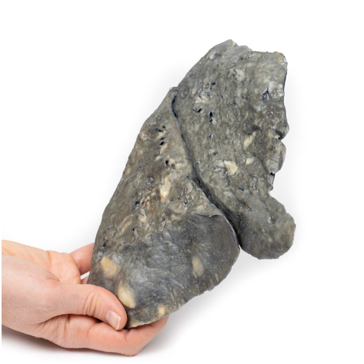 Lung—Multiple Secondary Carcinoma Deposits in The Lung and Pleura | EZ-MP2065 | Sim & Skills Ltd