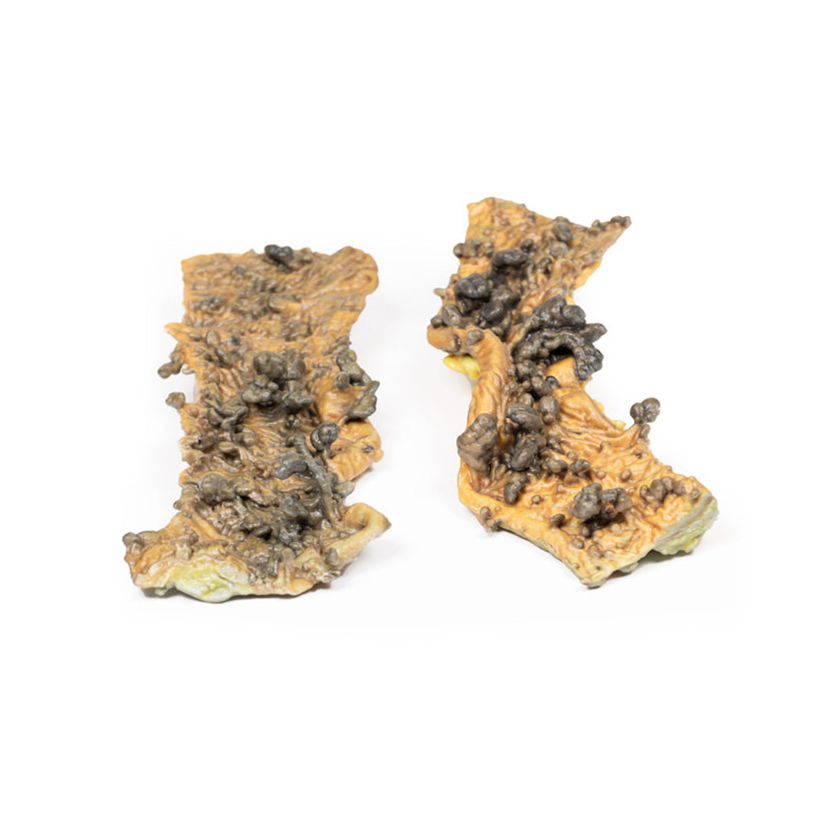 Multiple Polyposis Coli | EZ-MP2070 | Sim & Skills Ltd