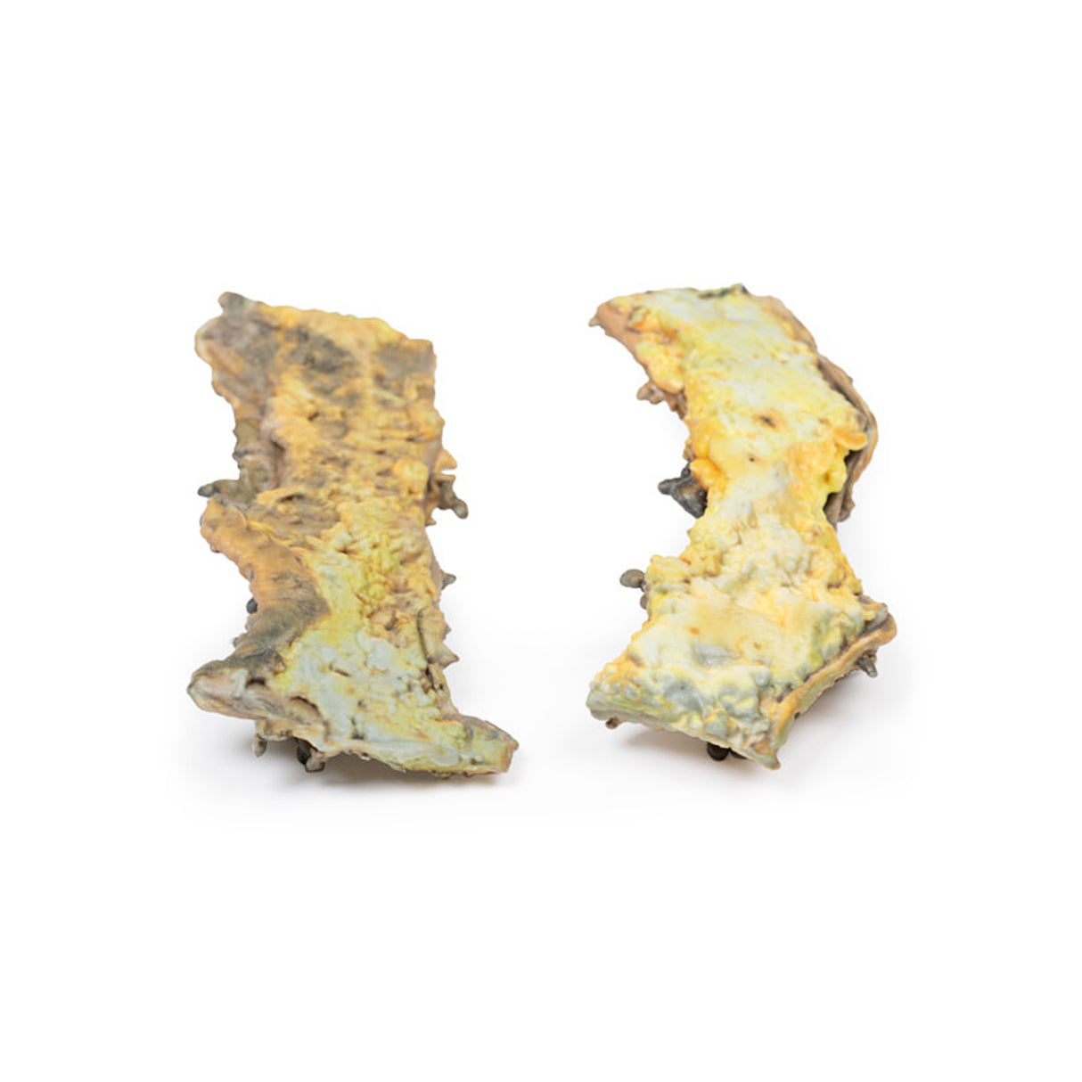 Multiple Polyposis Coli | EZ-MP2070 | Sim & Skills Ltd