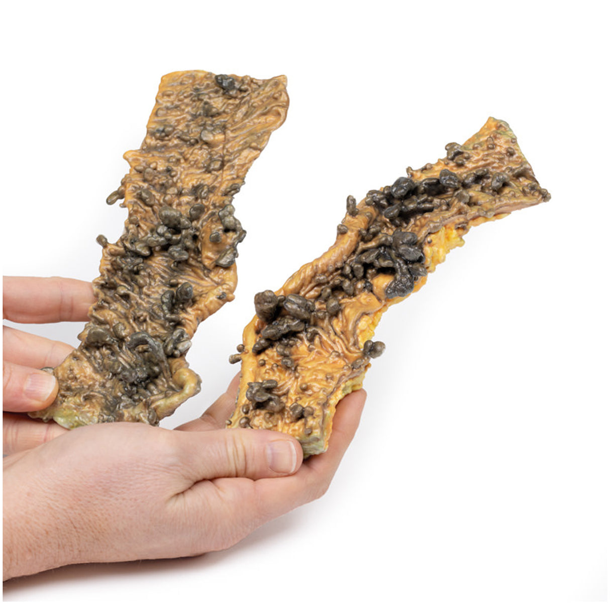 Multiple Polyposis Coli | EZ-MP2070 | Sim & Skills Ltd