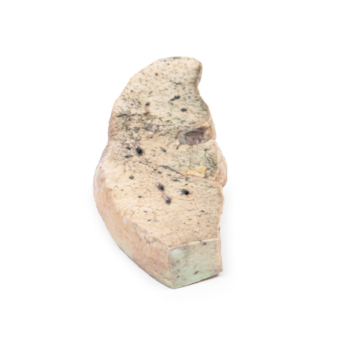 Liver cirrhosis | EZ-MP2073 | Sim & Skills Ltd