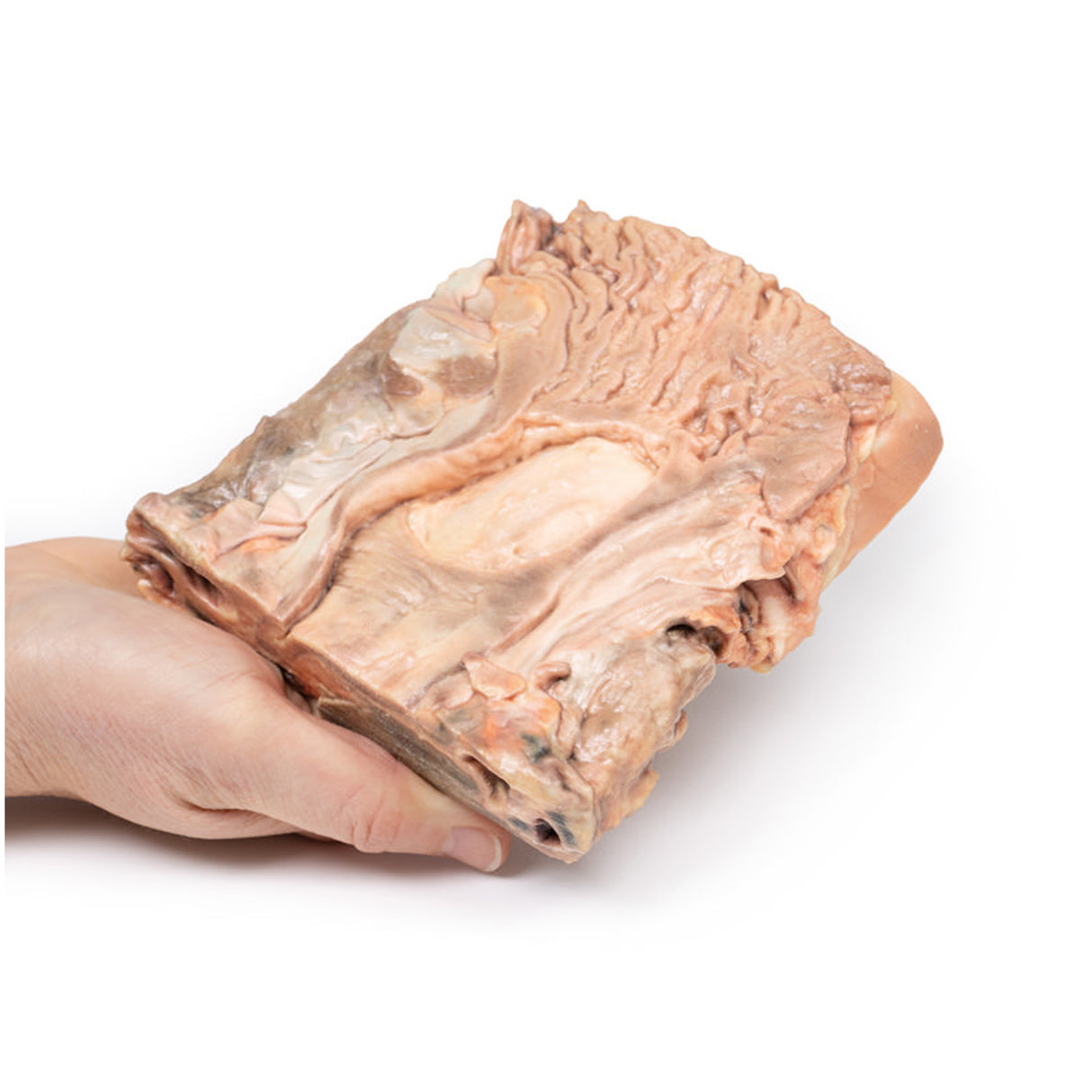 Chronic Gastric Ulcer | EZ-MP2076 | Sim & Skills Ltd
