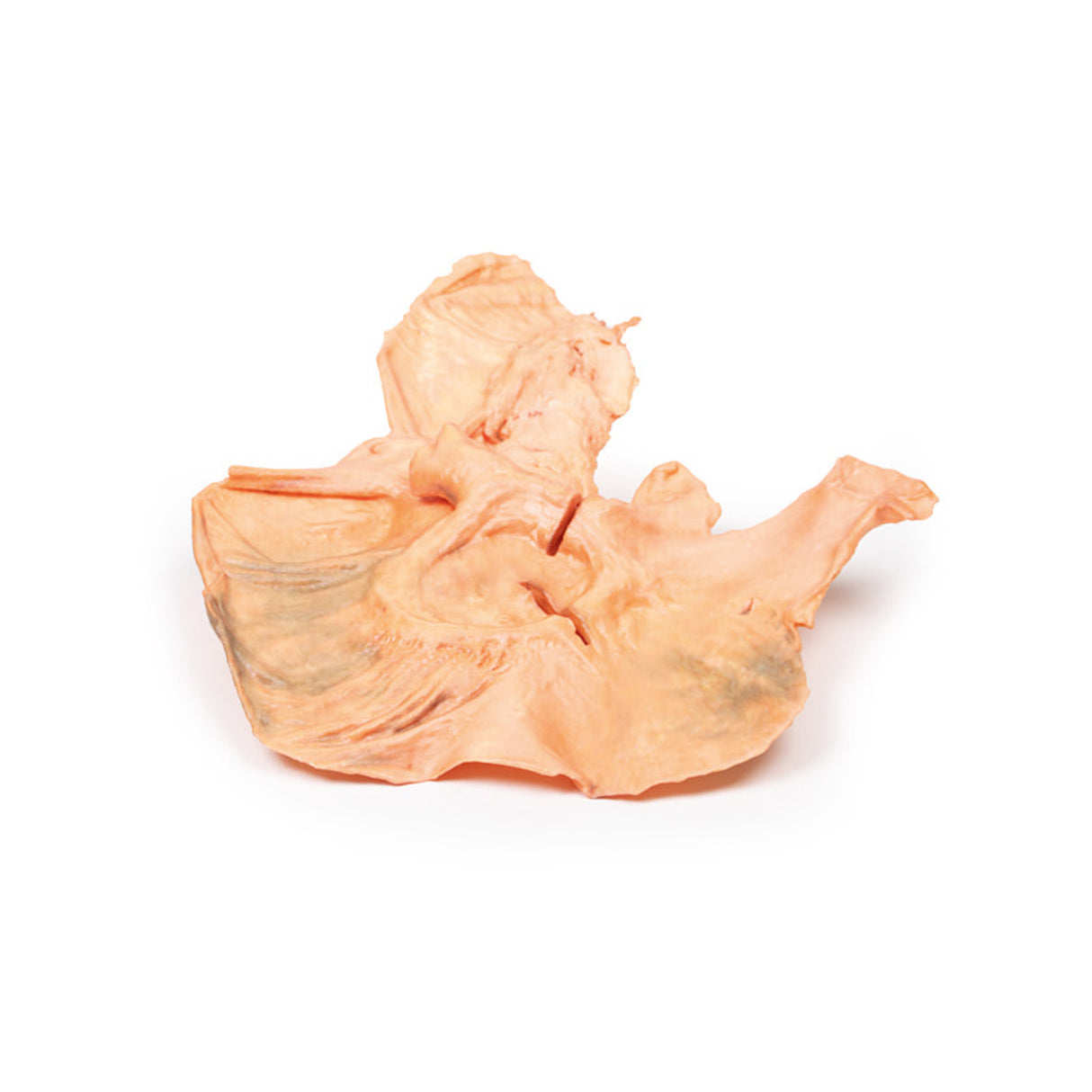 Adenocarcinoma of the stomach | EZ-MP2080 | Sim & Skills Ltd