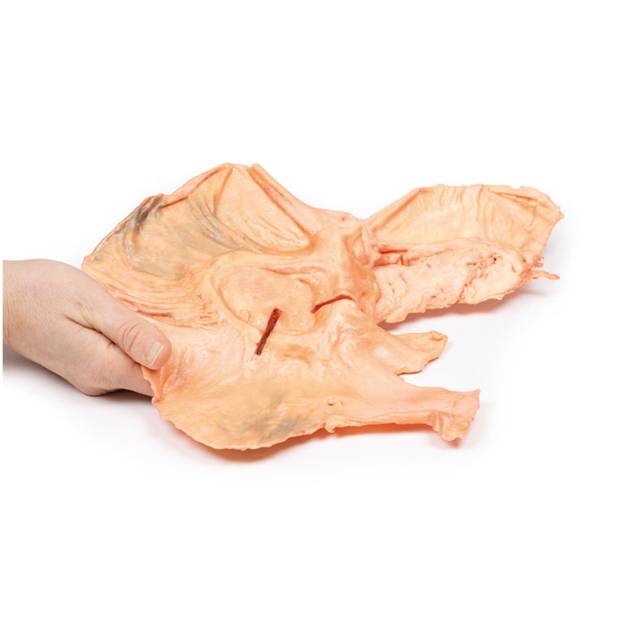 Adenocarcinoma of the stomach | EZ-MP2080 | Sim & Skills Ltd