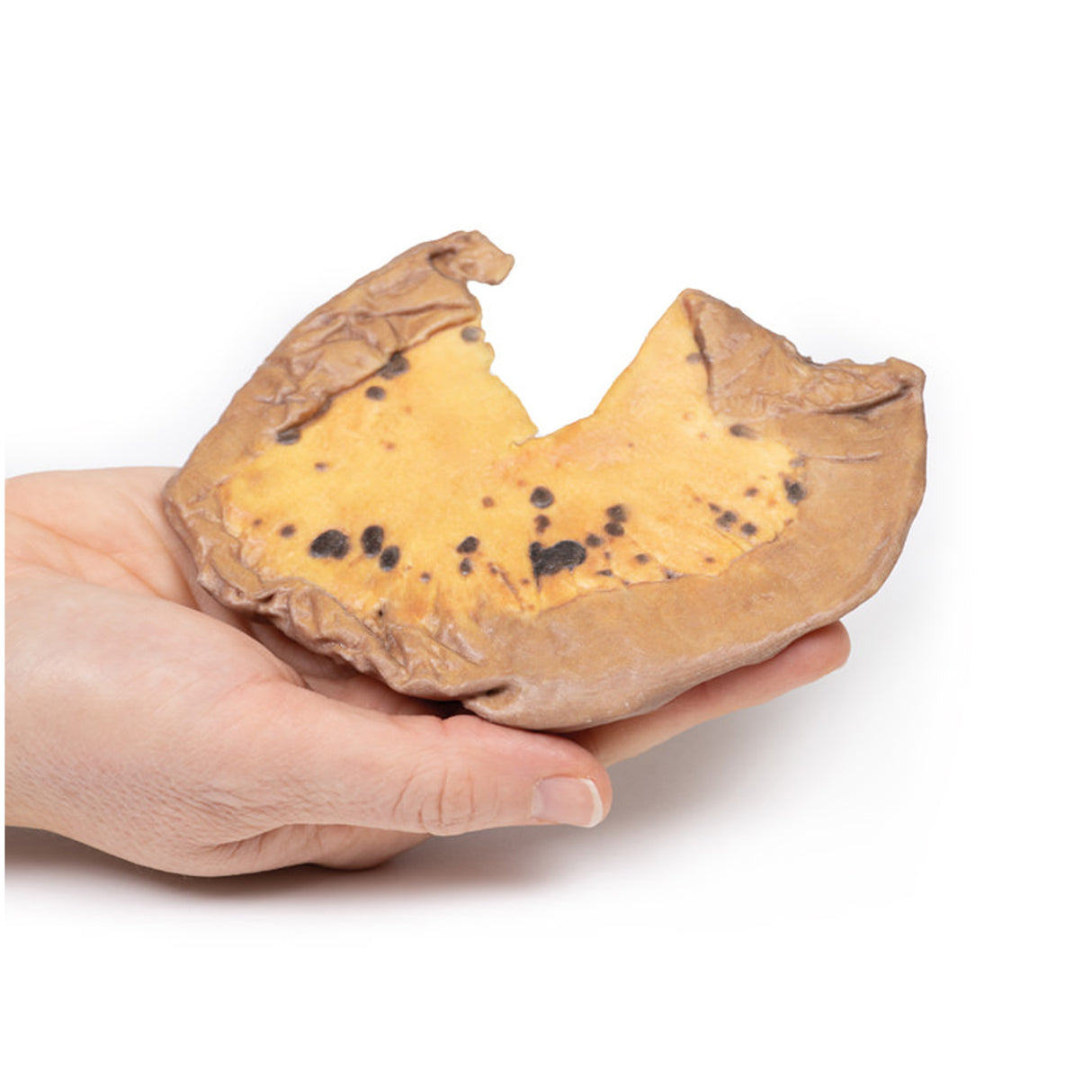 Mesenteric Metastases from Cutaneous Malignant Melanoma | EZ-MP2083 | Sim & Skills Ltd
