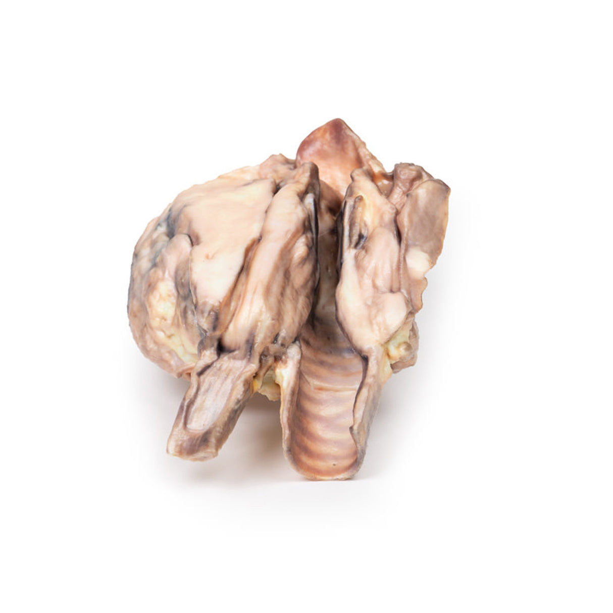 Lymphoma of the thyroid | EZ-MP2100 | Sim & Skills Ltd