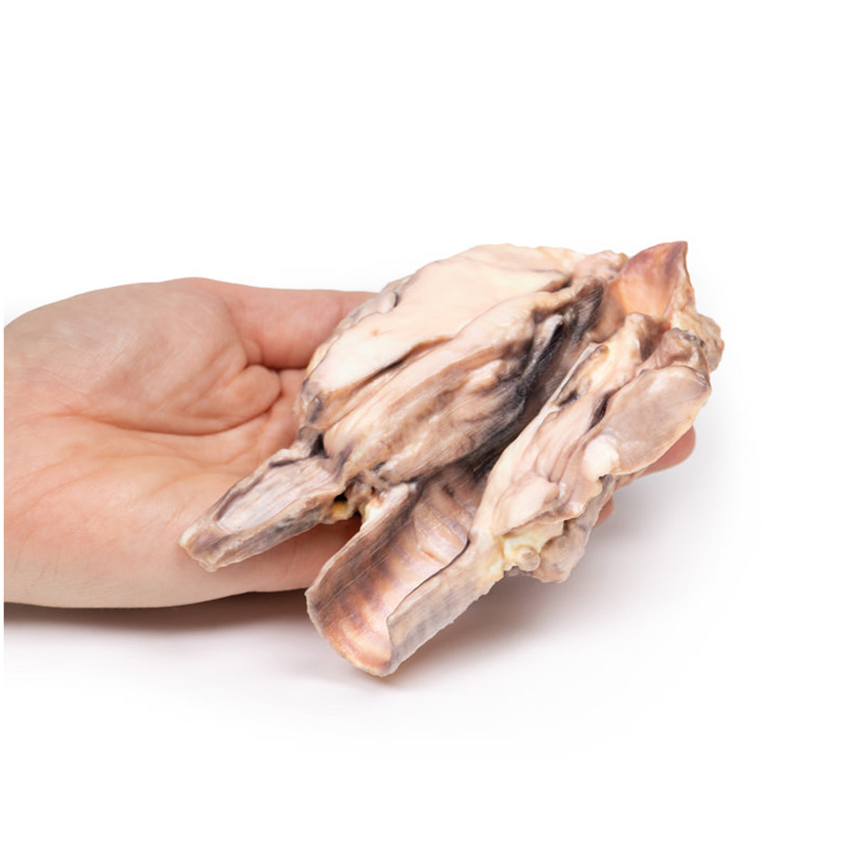 Lymphoma of the thyroid | EZ-MP2100 | Sim & Skills Ltd