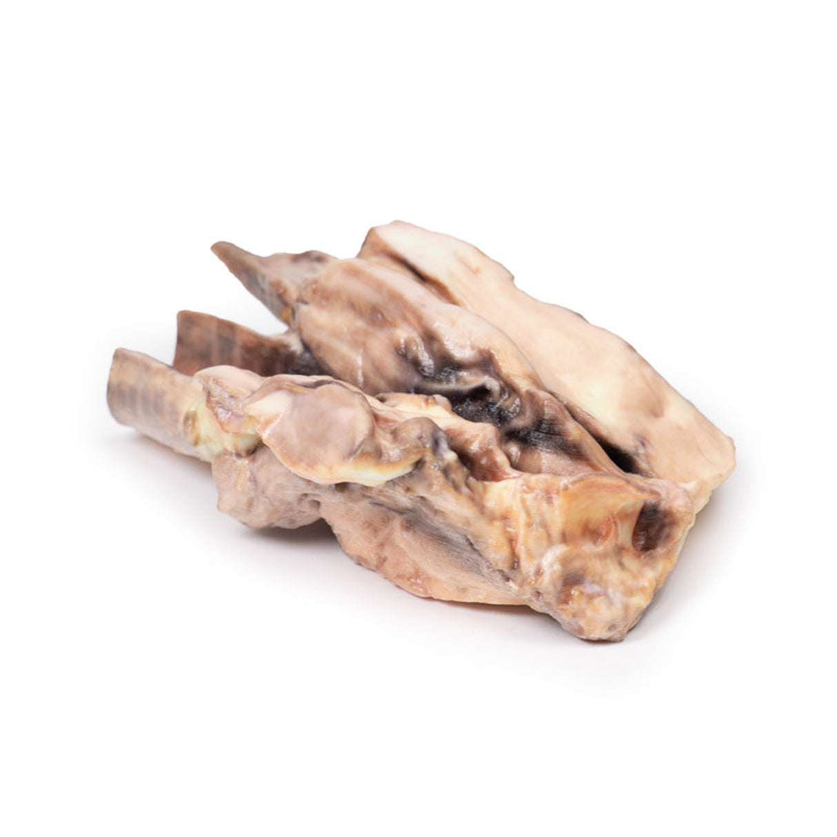 Lymphoma of the thyroid | EZ-MP2100 | Sim & Skills Ltd