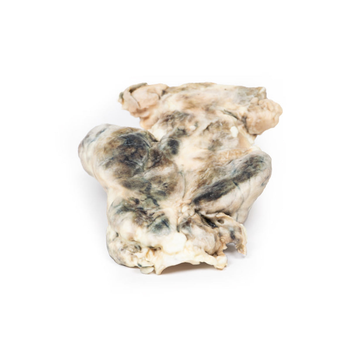 Multinodular goitre | EZ-MP2101 | Sim & Skills Ltd