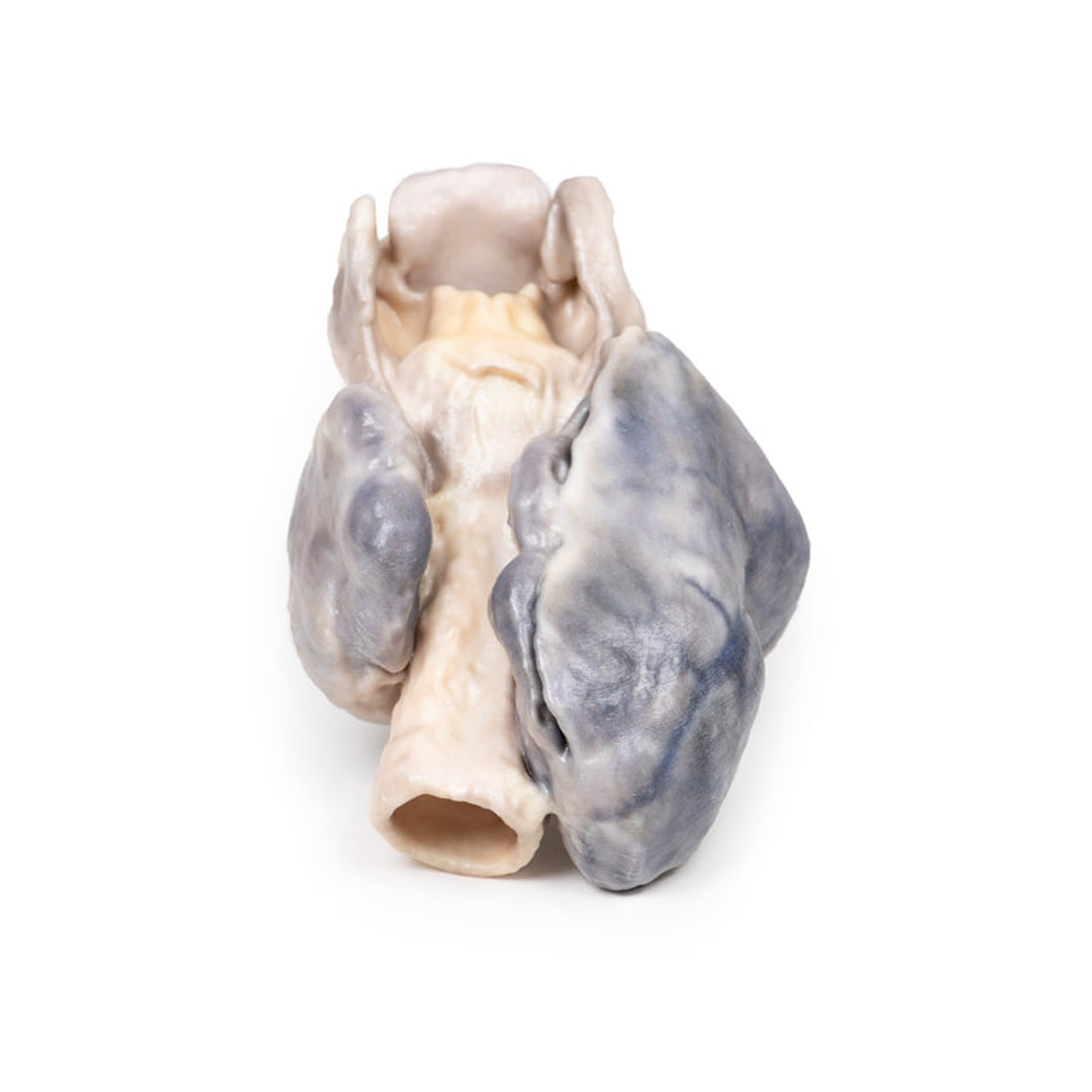 Retrosternal Goiter | EZ-MP2102 | Sim & Skills Ltd