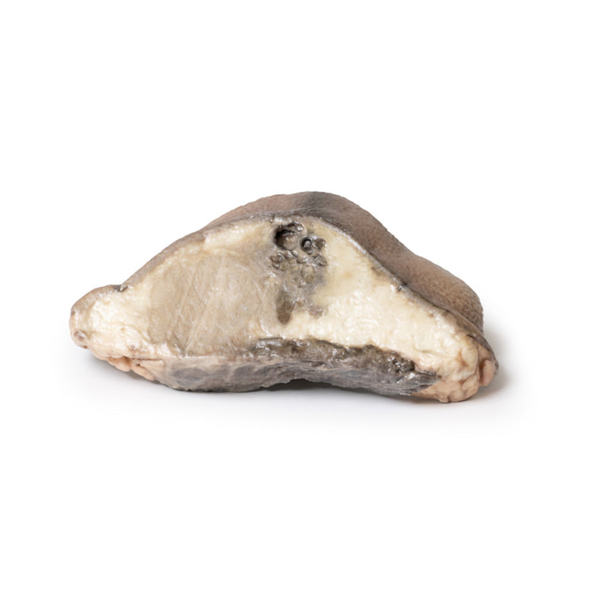 Carcinoma of Breast | EZ-MP2105 | Sim & Skills Ltd