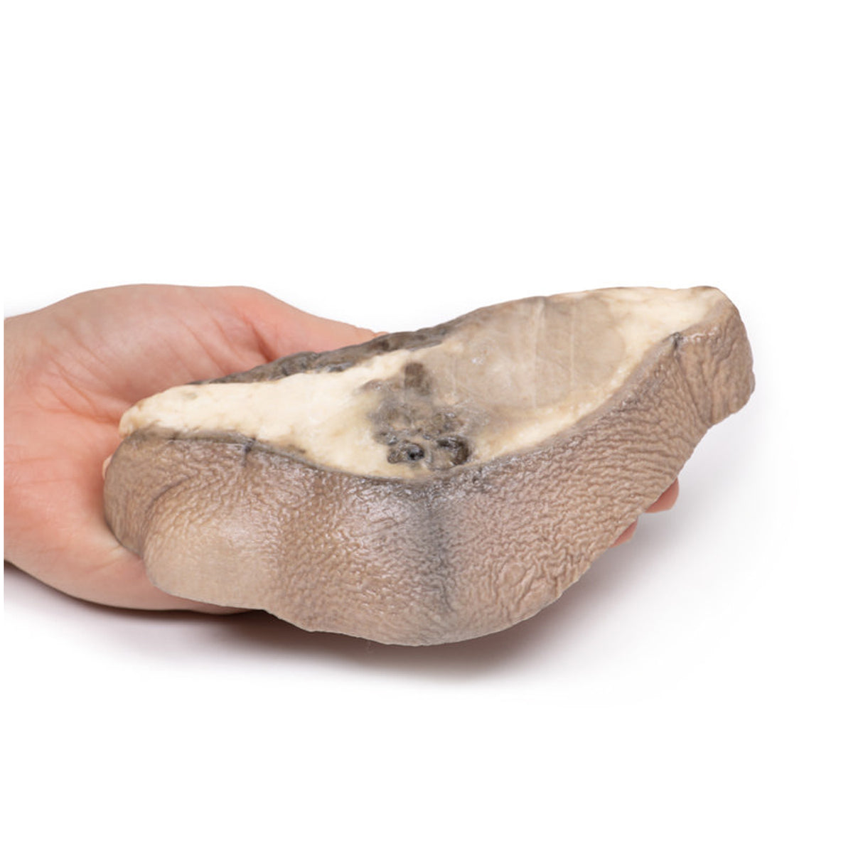 Carcinoma of Breast | EZ-MP2105 | Sim & Skills Ltd