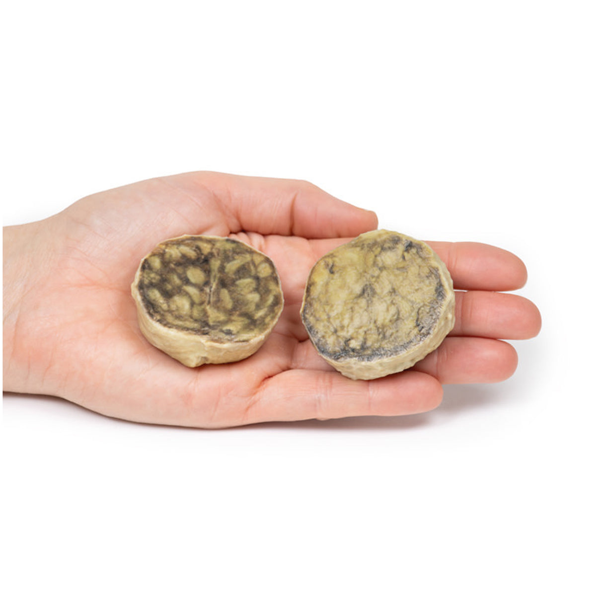 Nodular hyperplasia of the Prostate | EZ-MP2108 | Sim & Skills Ltd