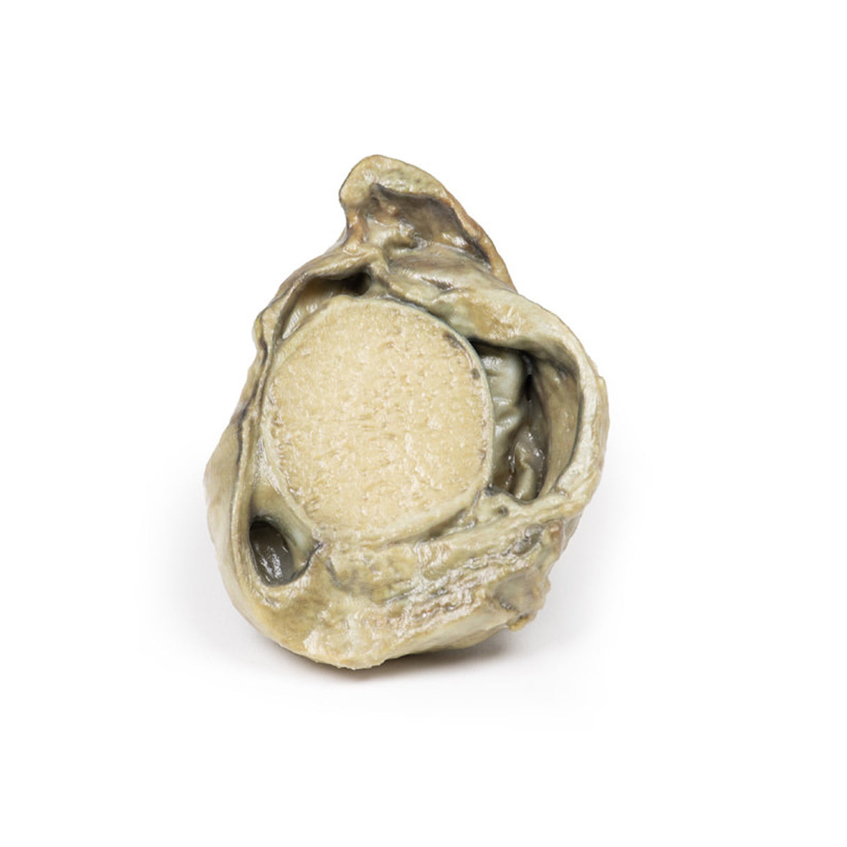 Hydrocoele | EZ-MP2109 | Sim & Skills Ltd