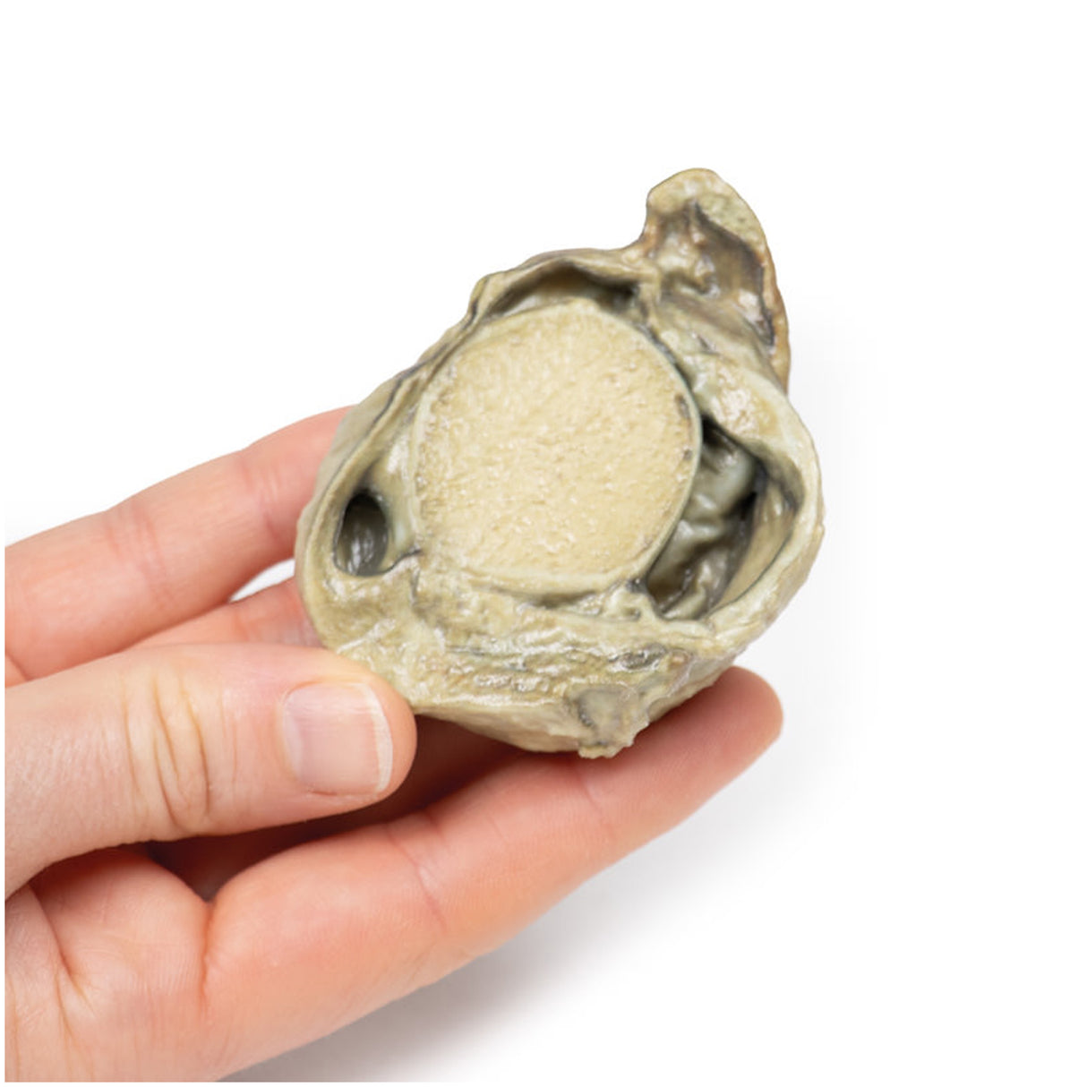 Hydrocoele | EZ-MP2109 | Sim & Skills Ltd