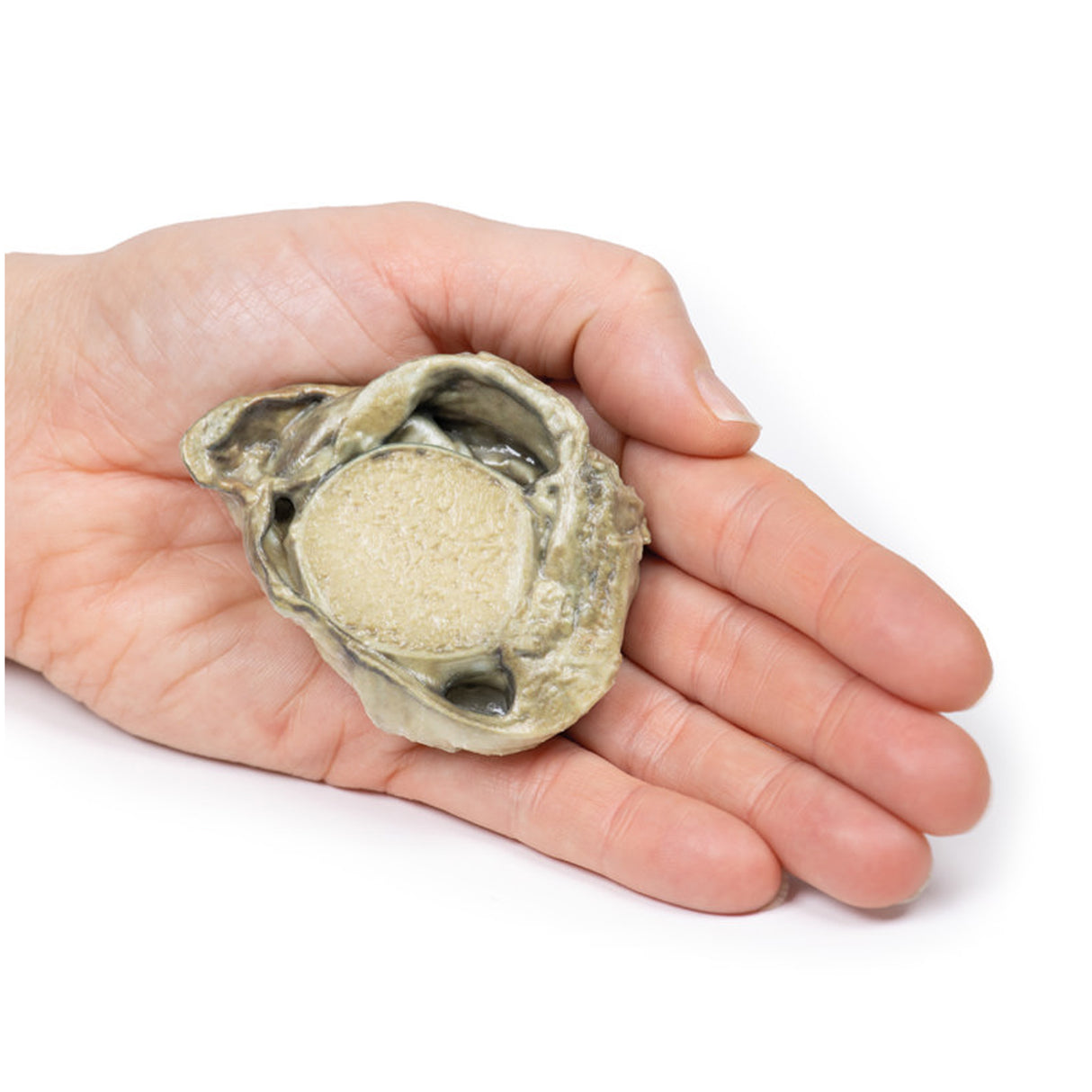 Hydrocoele | EZ-MP2109 | Sim & Skills Ltd