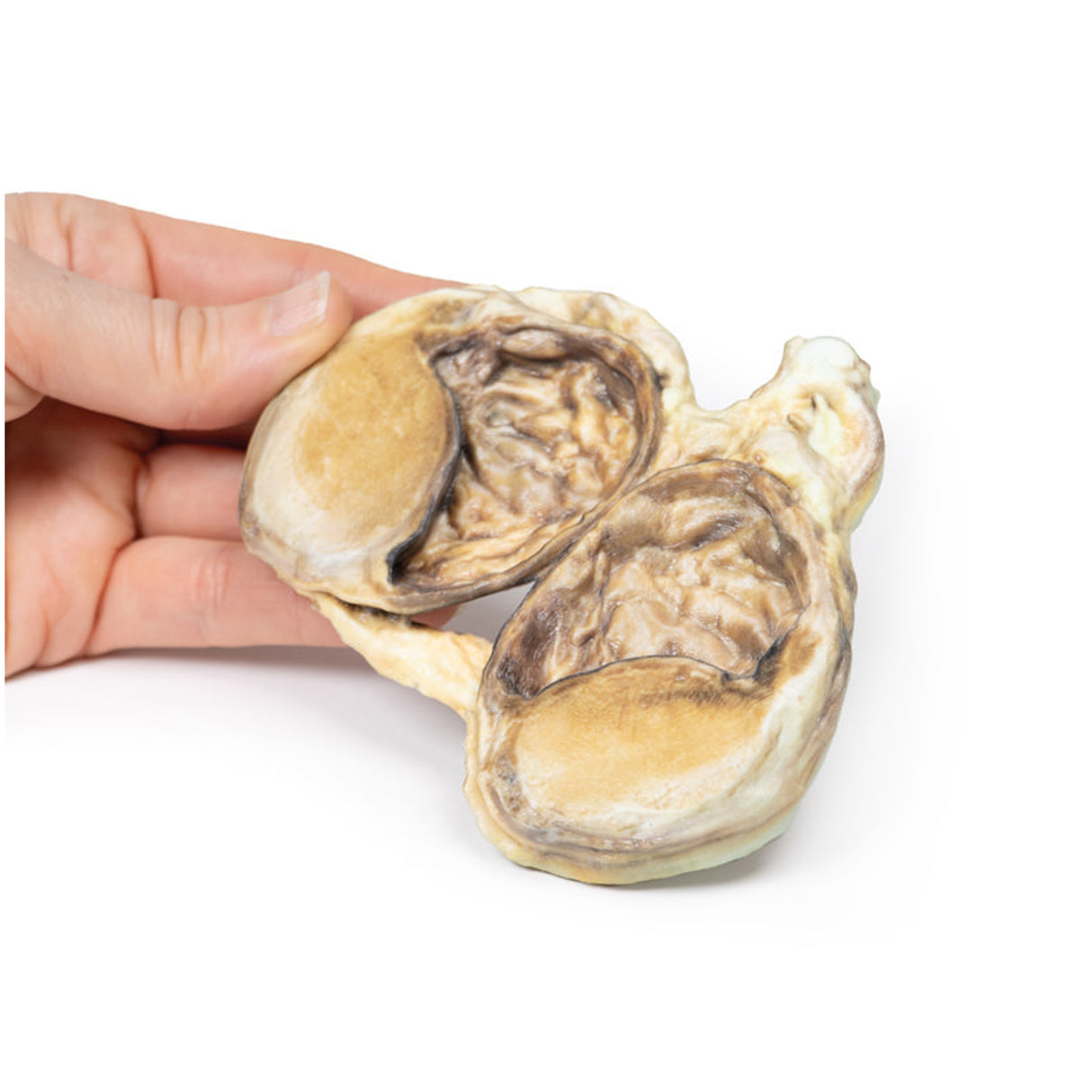 Chronic hydrocoele | EZ-MP2110 | Sim & Skills Ltd