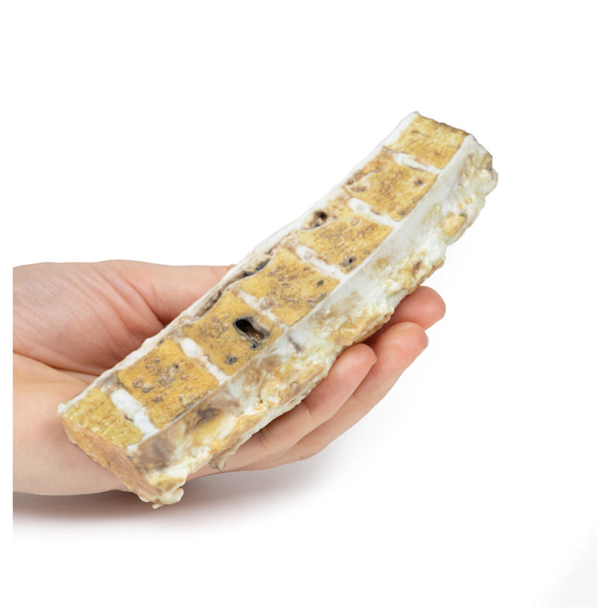 Tuberculosis | EZ-MP2111 | Sim & Skills Ltd