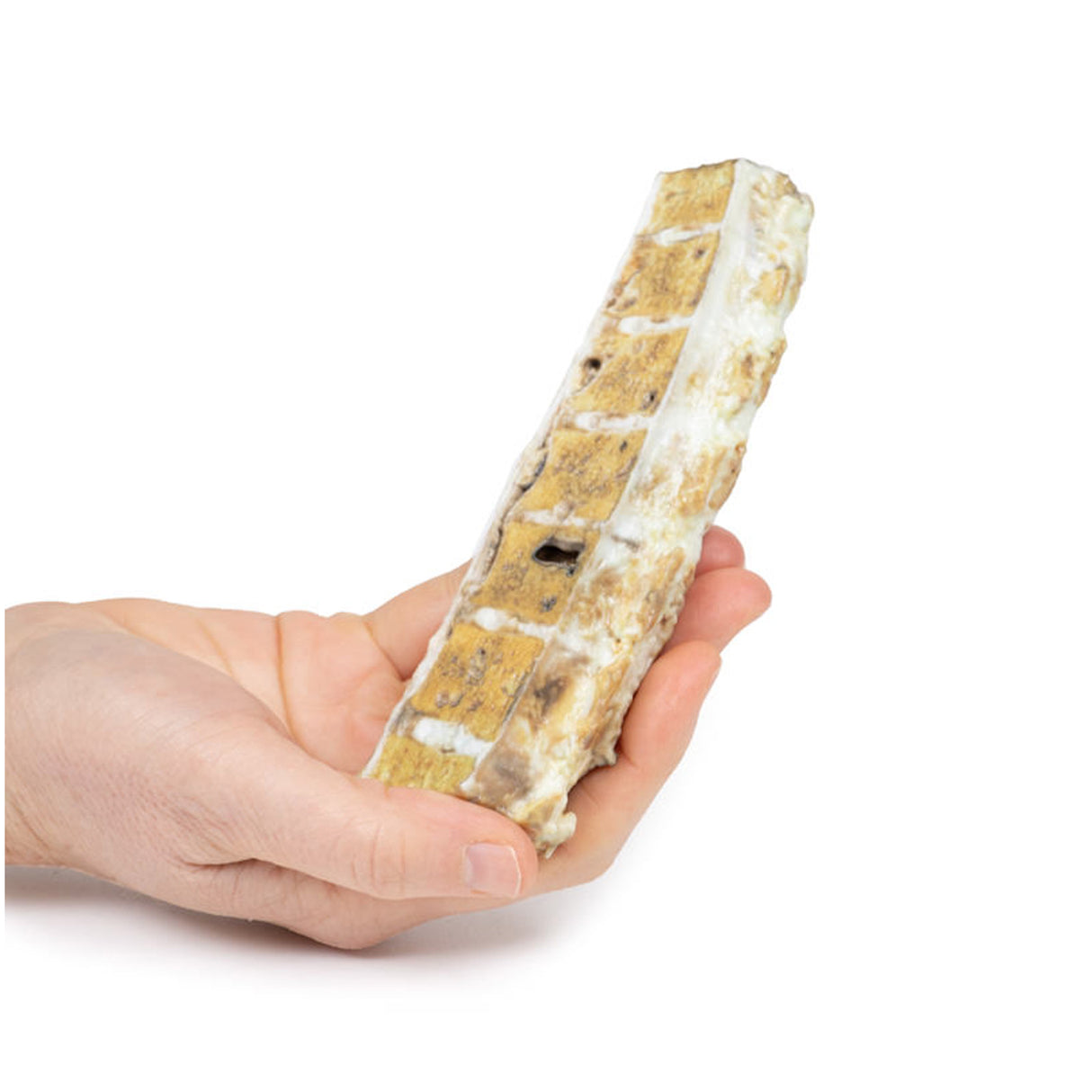 Tuberculosis | EZ-MP2111 | Sim & Skills Ltd