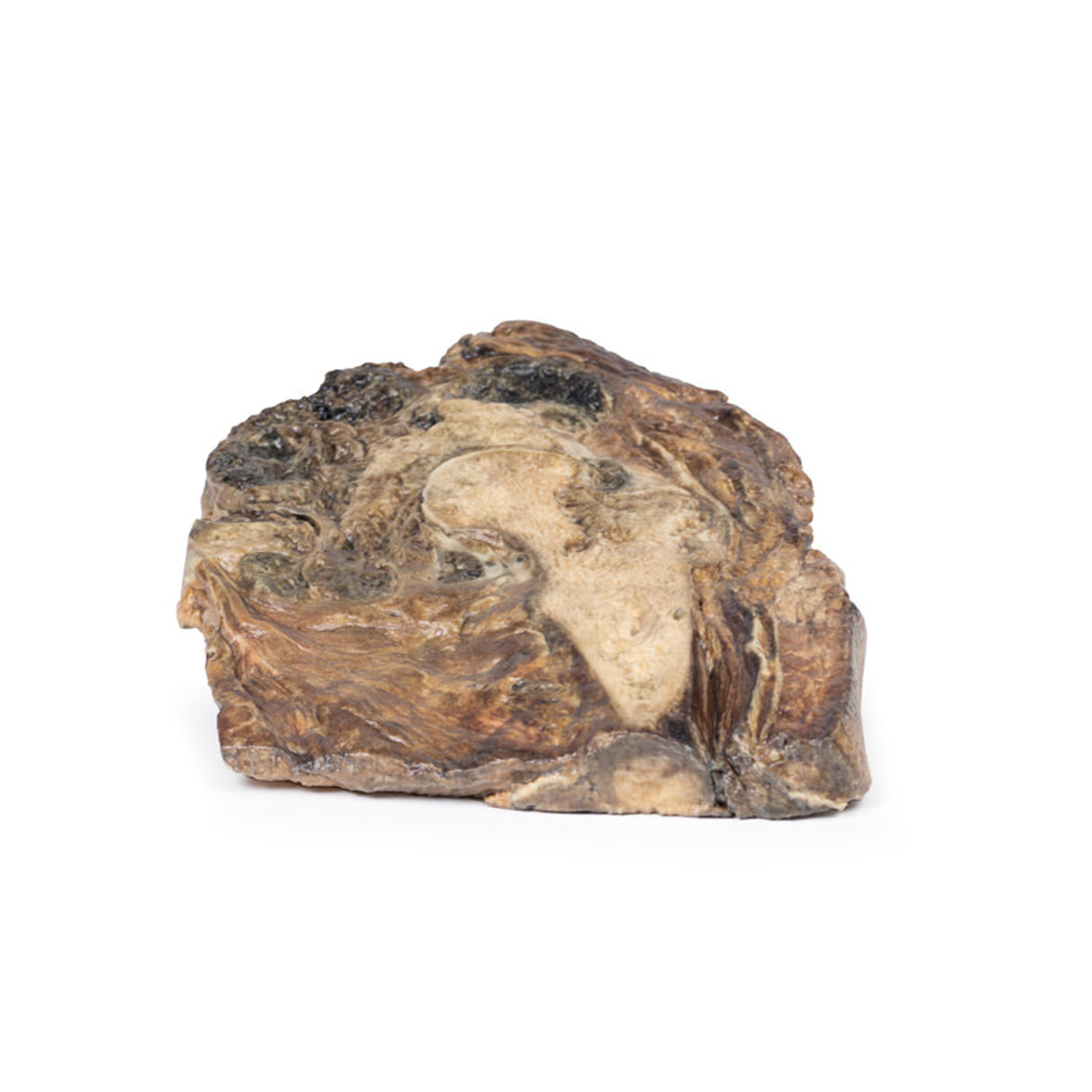 Chondrosarcoma of femur and ilium | EZ-MP2112 | Sim & Skills Ltd