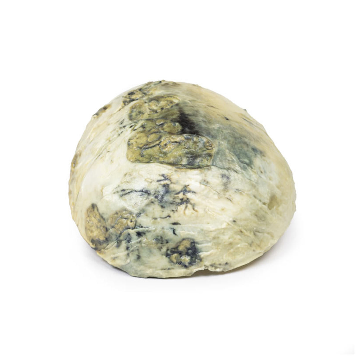 Tertiary Syphilis | EZ-MP2113 | Sim & Skills Ltd