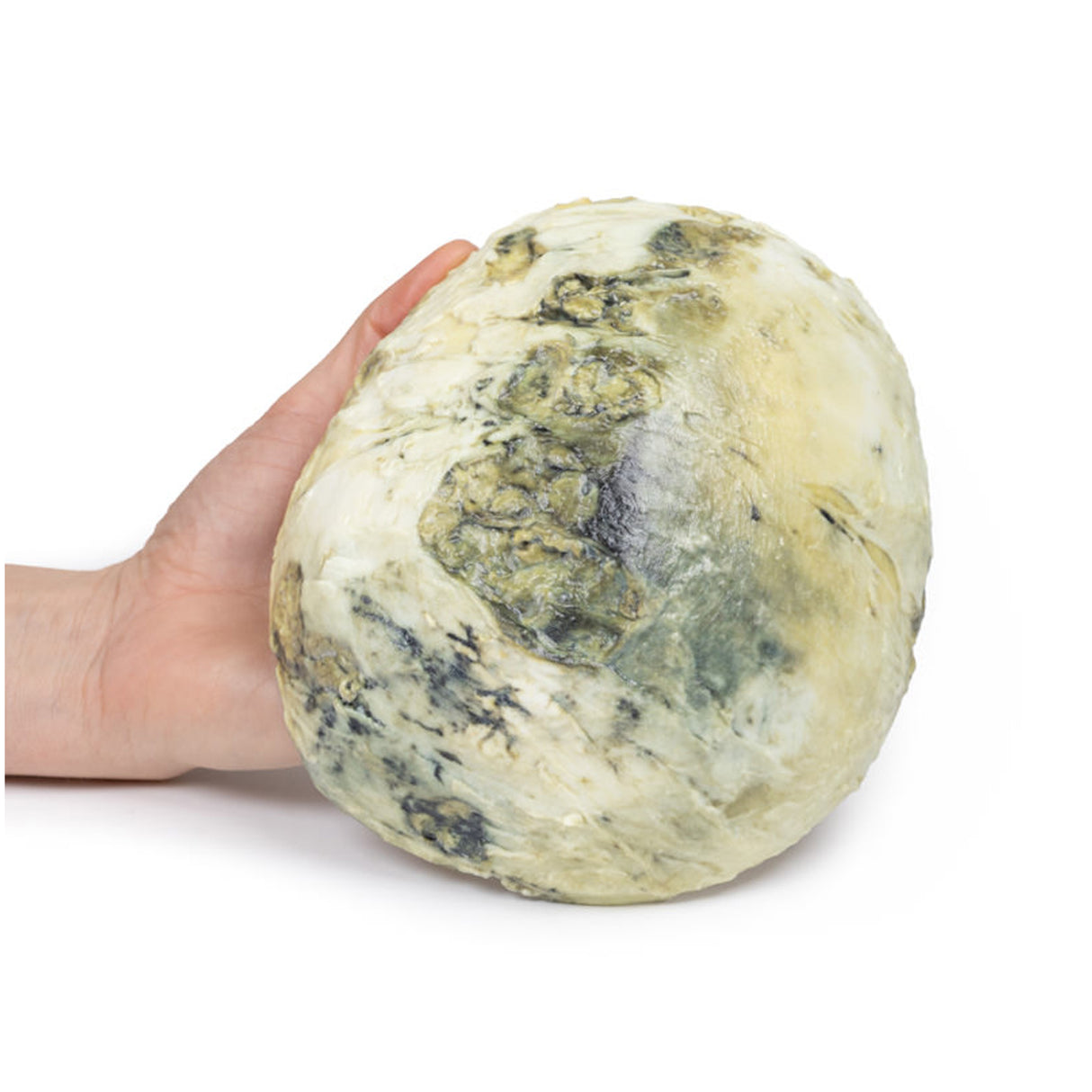 Tertiary Syphilis | EZ-MP2113 | Sim & Skills Ltd