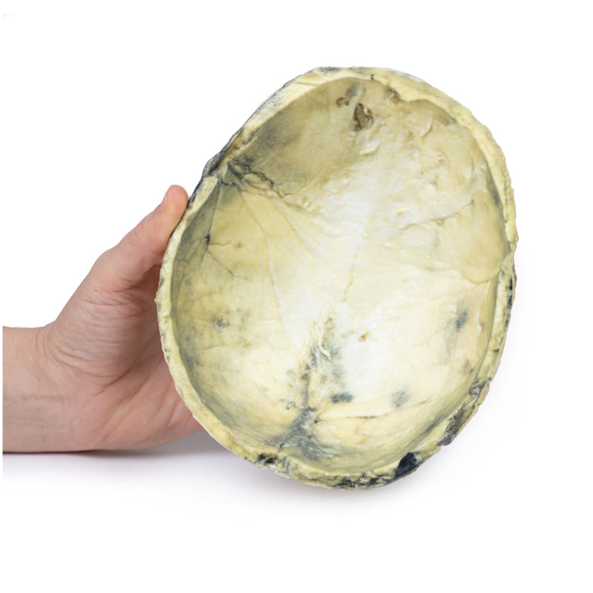 Tertiary Syphilis | EZ-MP2113 | Sim & Skills Ltd