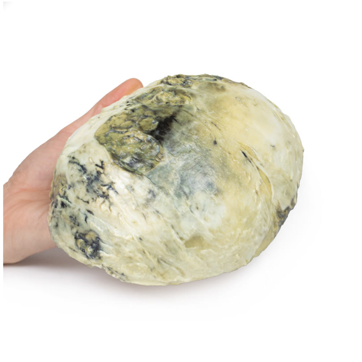 Tertiary Syphilis | EZ-MP2113 | Sim & Skills Ltd