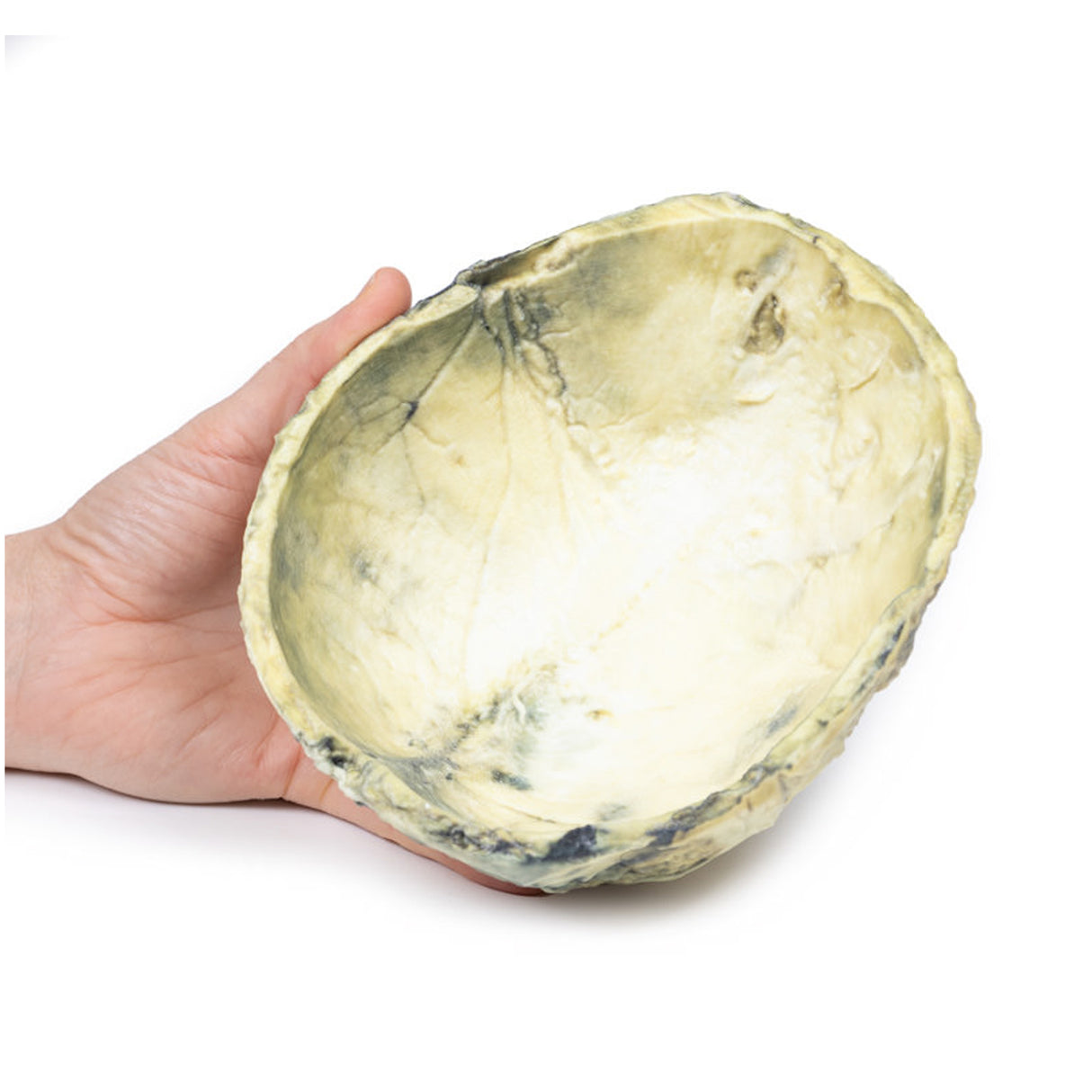 Tertiary Syphilis | EZ-MP2113 | Sim & Skills Ltd