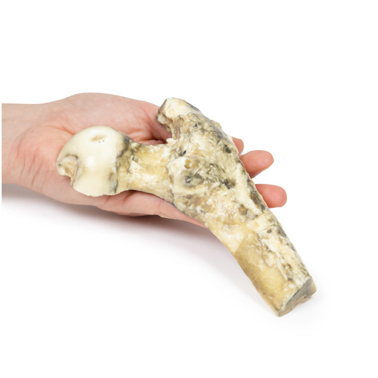 Metastatic Malignant Melanoma | EZ-MP2117 | Sim & Skills Ltd