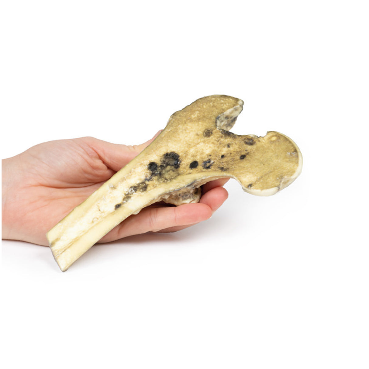 Metastatic Malignant Melanoma | EZ-MP2117 | Sim & Skills Ltd