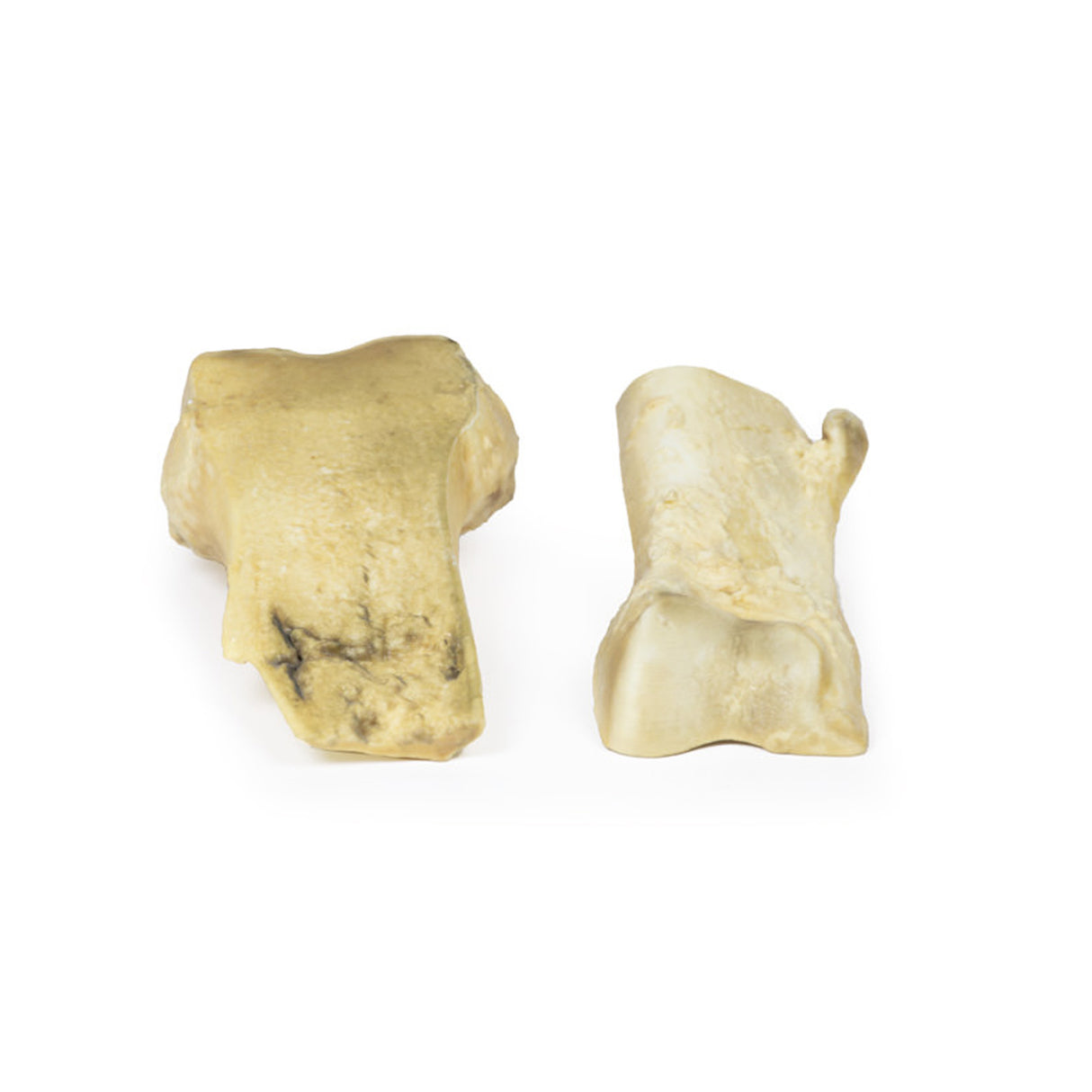 Osteochondroma | EZ-MP2118 | Sim & Skills Ltd