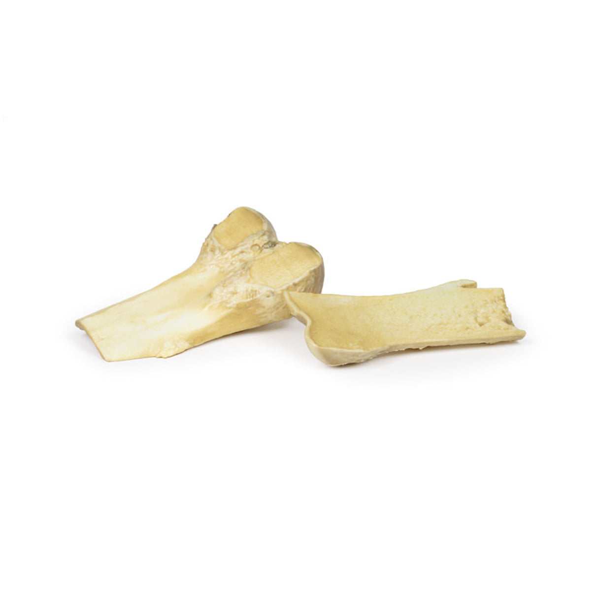 Osteochondroma | EZ-MP2118 | Sim & Skills Ltd