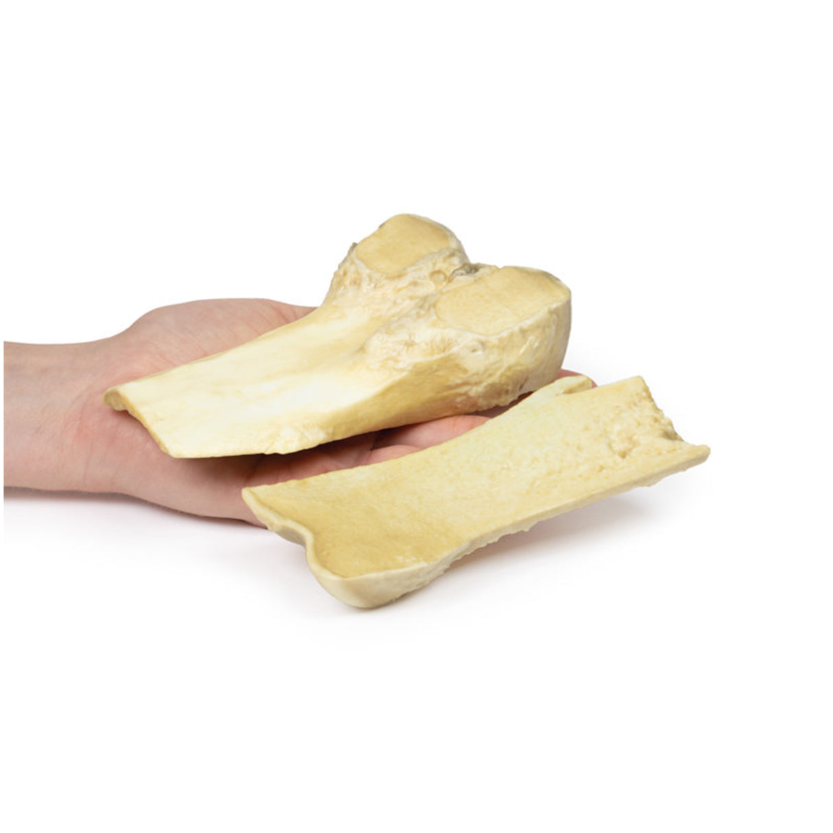 Osteochondroma | EZ-MP2118 | Sim & Skills Ltd