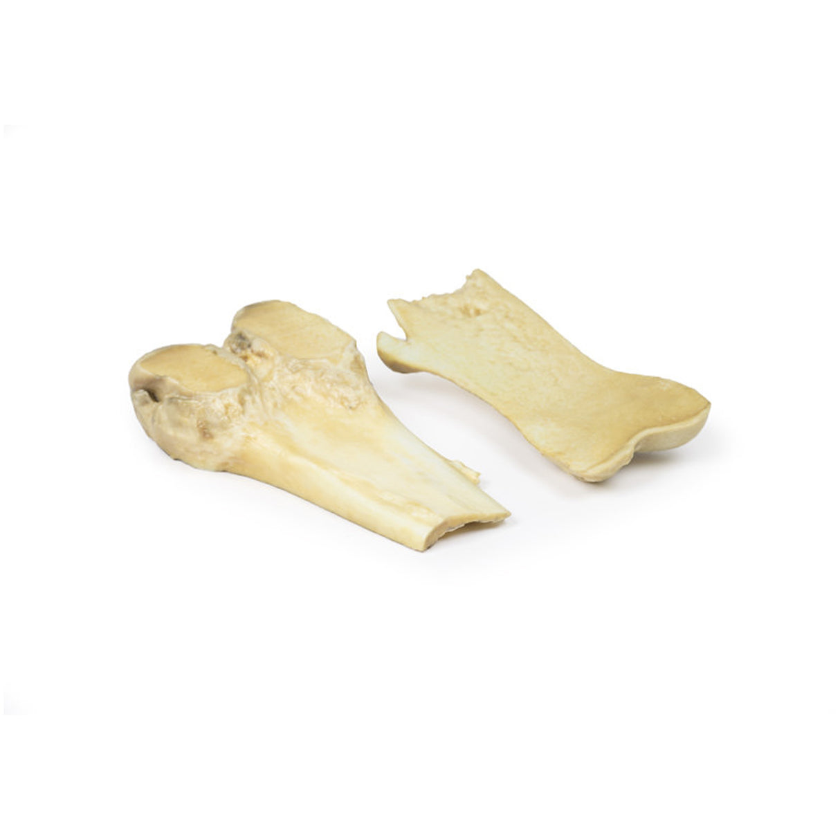 Osteochondroma | EZ-MP2118 | Sim & Skills Ltd