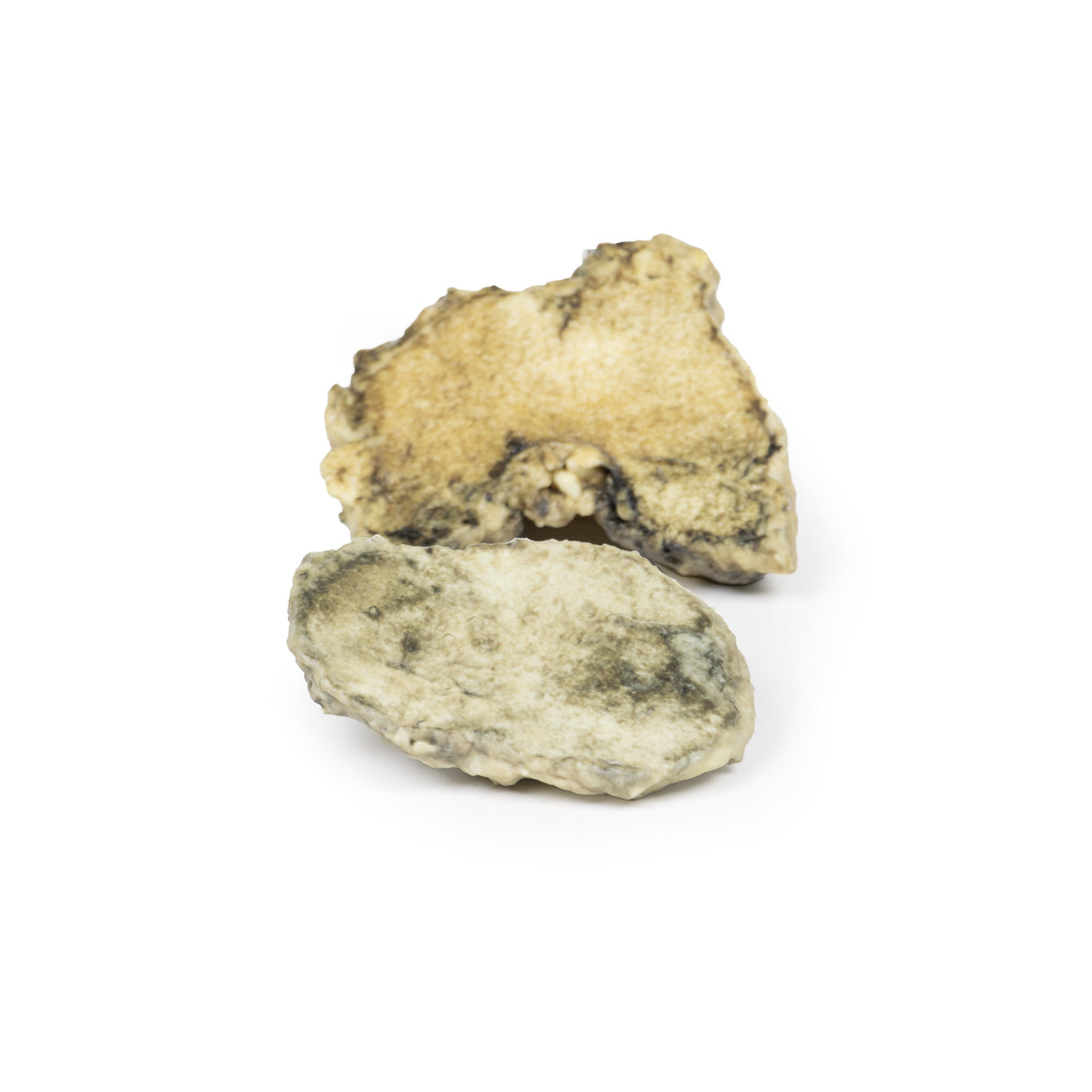 Suppurative arthritis of the knee | EZ-MP2119 | Sim & Skills Ltd