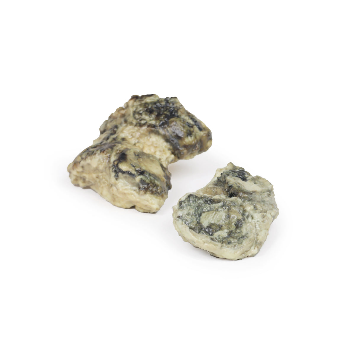 Suppurative arthritis of the knee | EZ-MP2119 | Sim & Skills Ltd