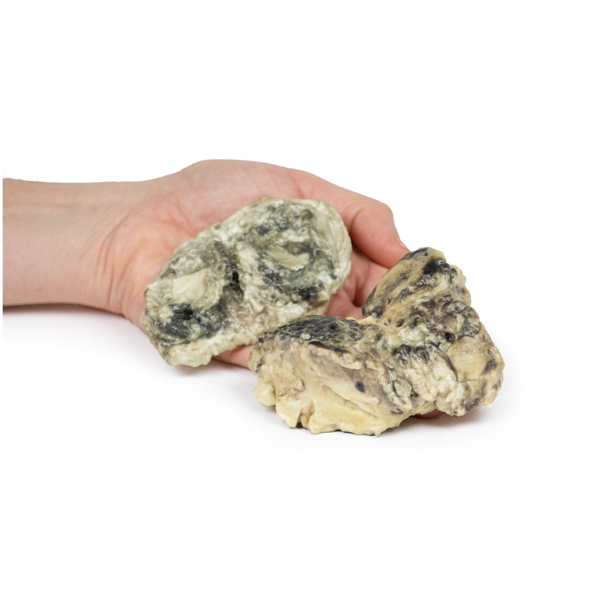 Suppurative arthritis of the knee | EZ-MP2119 | Sim & Skills Ltd