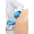 Midscapular Thoracentesis Ultrasound Training Model BPTT2-1005 | Sim & Skills