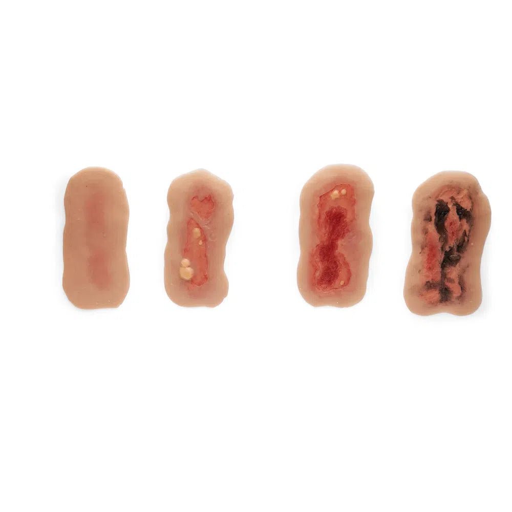 Adhesive Simulated Burns - 4 stages kit P-PCBPK4-001-M | Sim & Skills
