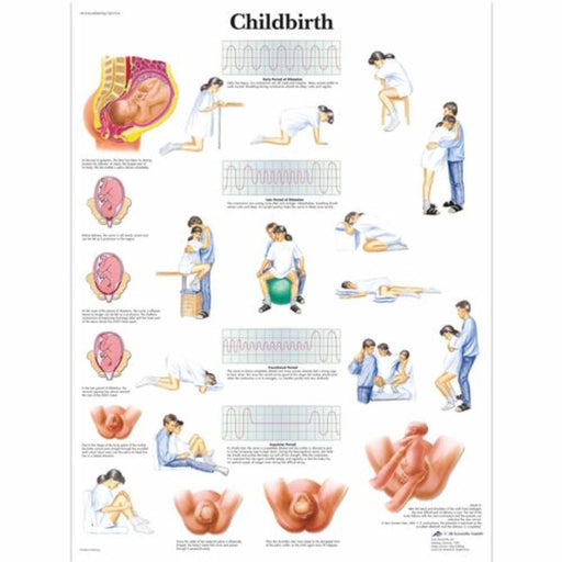 Childbirth Chart 4006704 | Sim & Skills