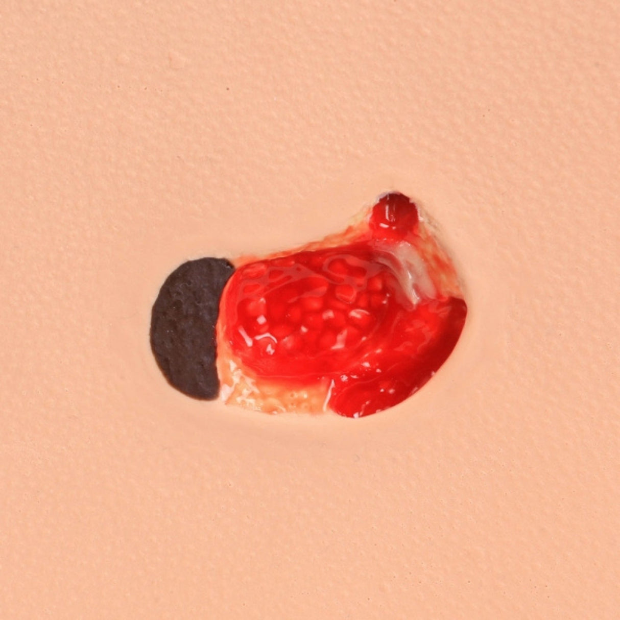 PAT Pressure Injury Staging Model VTA0980 | Sim & Skills