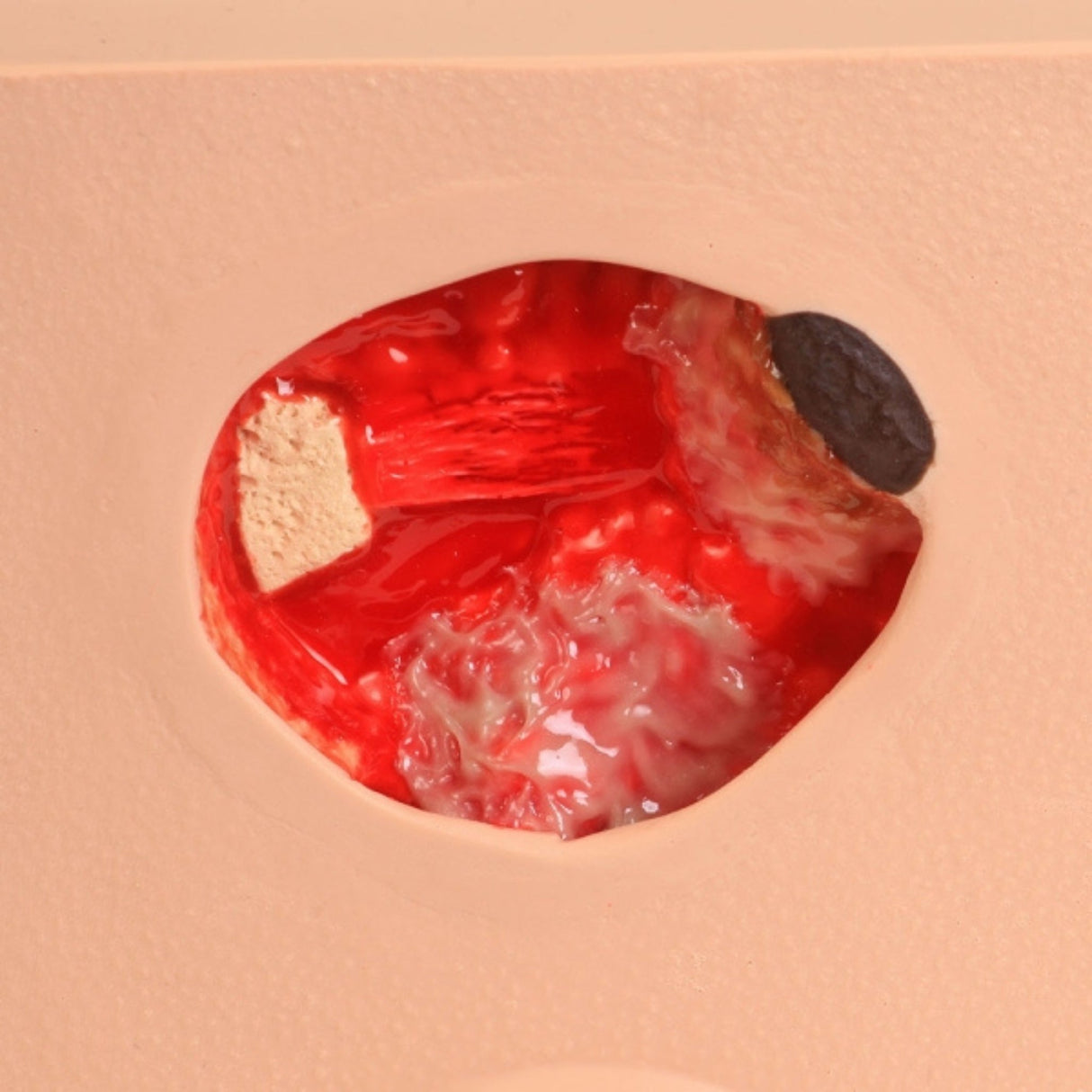 PAT Pressure Injury Staging Model VTA0980 | Sim & Skills