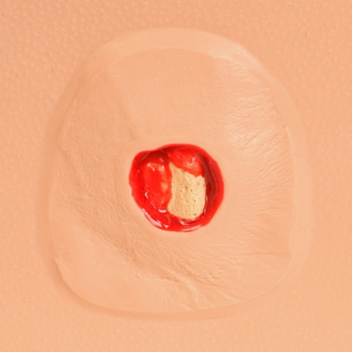 PAT Pressure Injury Staging Model VTA0980 | Sim & Skills